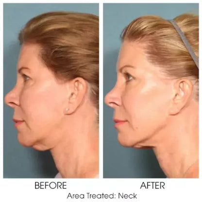 Magec Collagen Fullerene Neck Cream - Tightening & Anti-Wrinkle Formula
